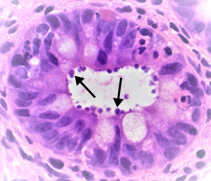 Gastrointestinal - organisms in the glands Gastrointestinal - organisms in the glands - AHLab