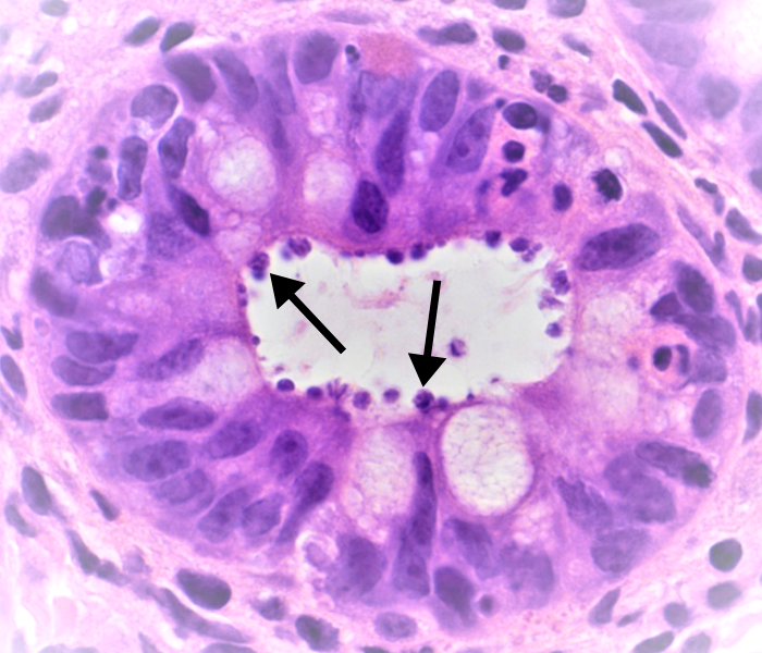 Gastrointestinal - organisms in the glands - AHLab